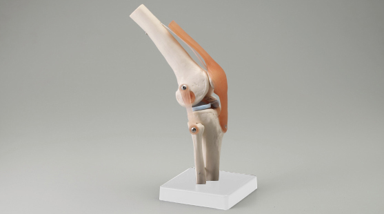 S＋CURE】膝関節模型 - 模型 - 模型・ポスター - メディカル | きゅあ 